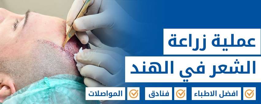 جراحة زراعة الشعر